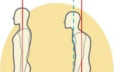 猫背と正しい姿勢